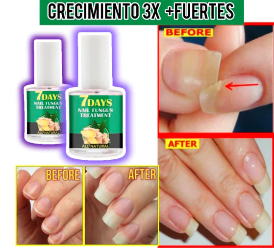 (COMPRA 1 & LLEVA 2)🎁 Avanzado💅Serum Uñas 7 Días 7 VECES + LARGAS😍 - [PROMOCIÓN DISPONIBLE SOLO HOY]