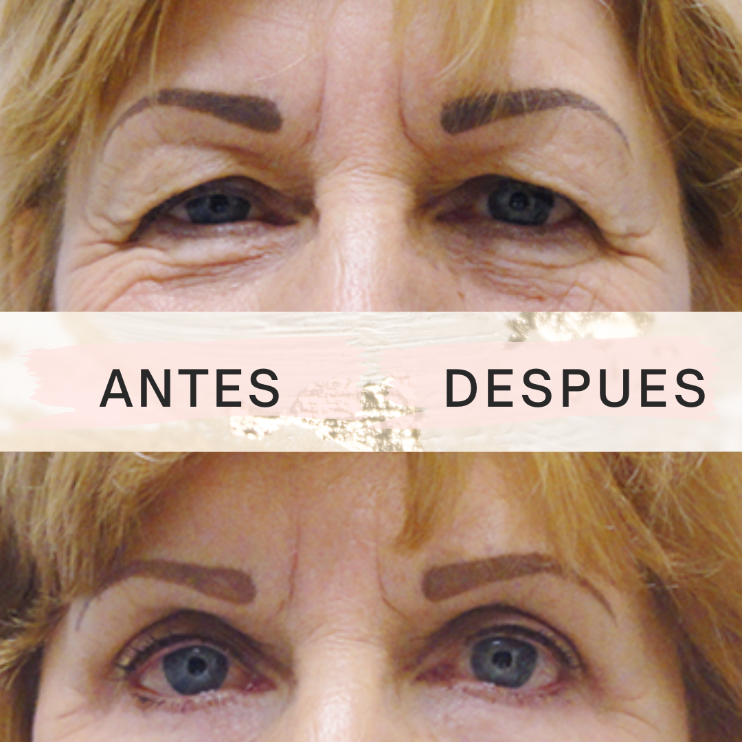 Eyelid PushUp 🤩Mirada Impactante al instante✨ 120 Pares!😱 - [PROMOCIÓN DISPONIBLE SOLO HOY]