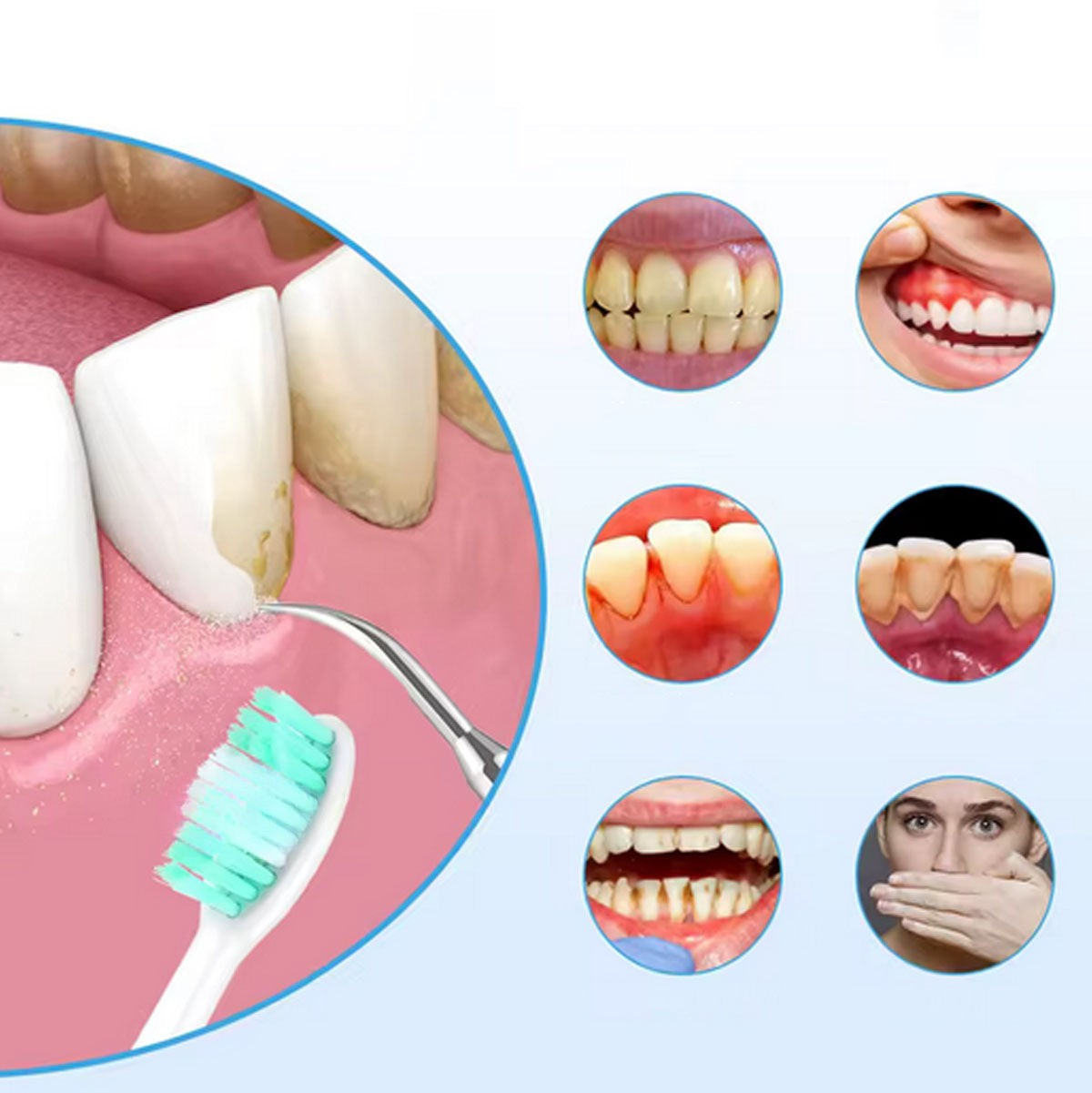 SmileClean - Cepillo De Dientes y Eliminador De sarro