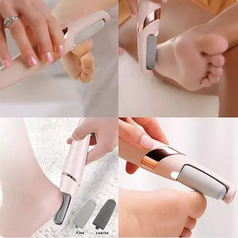 SuavePies – Elimina grietas y callos en minutos